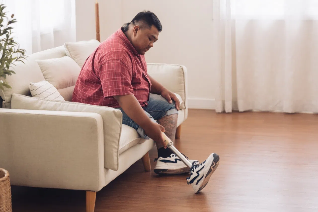 overweight person prosthetics