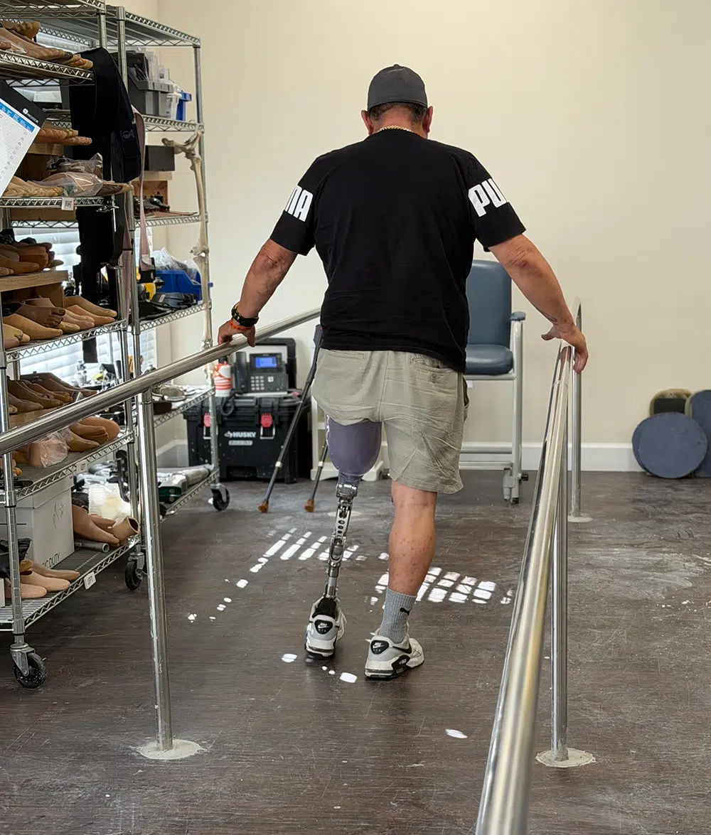amputation recovery, recovery after amputation, mobility after amputation