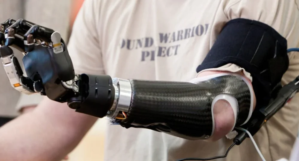 High-Fidelity Interface (HiFi) for Prosthetic Sockets