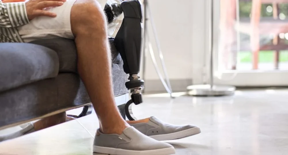 What Are The Steps in Being Fitted For a Prosthetic Device