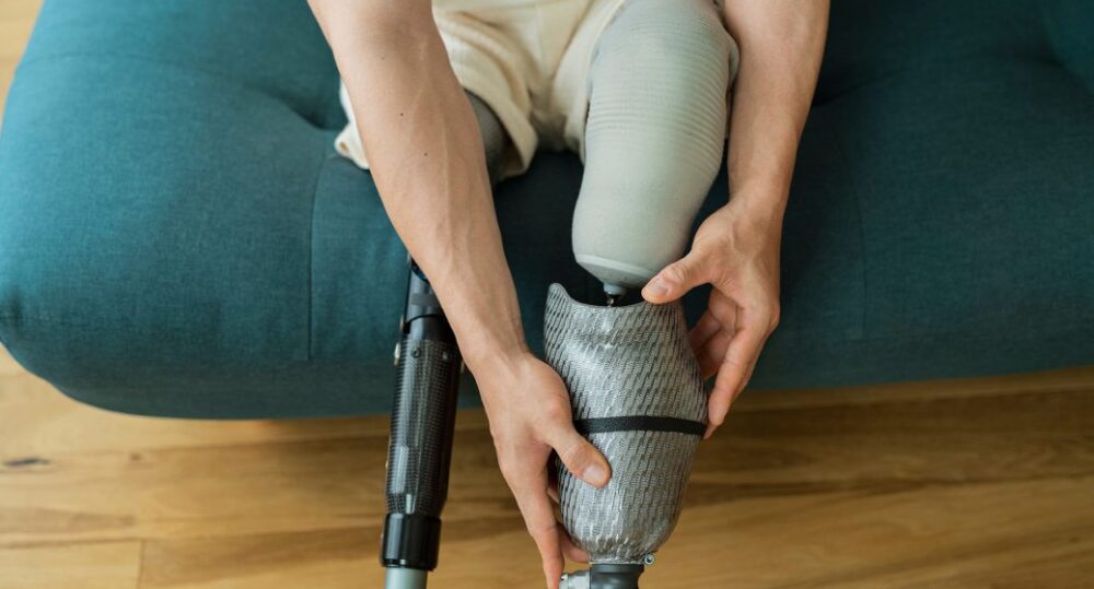 does-insurance-cover-prosthetics-ro5sl6ya4yvyabl5f2m8yik1jo04x3c30qcpk49e5c