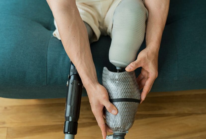 does-insurance-cover-prosthetics-ro5sl6ya4yvyabl5f2m8yik1jo04x3c30qcpk49e5c