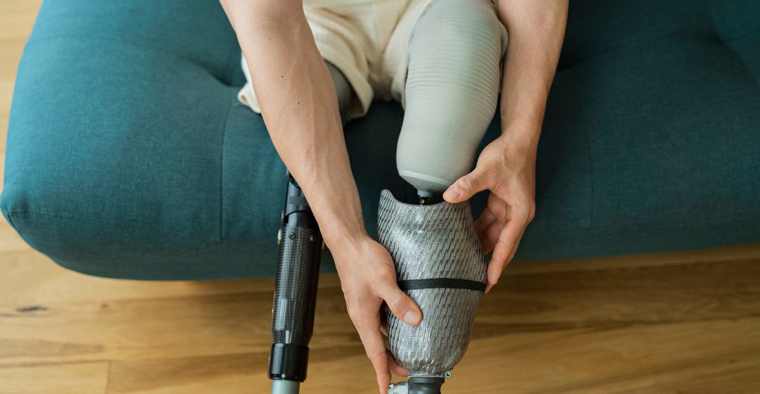 does Medicare cover prosthetics Medicare prosthetic coverage prosthetic limb insurance coverage does Medicare pay for prosthetic limbs